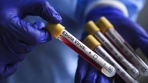Taraba Plans Airport Screening, Steps Up Ebola Surveillance